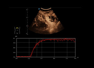 
                  
                    SonoScape P60 Trolley Color Doppler
                  
                