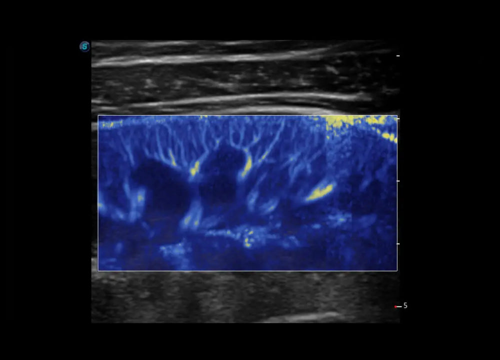 
                  
                    SonoScape P60 Trolley Color Doppler
                  
                