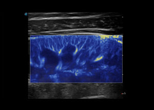 
                  
                    SonoScape P60 Trolley Color Doppler
                  
                
