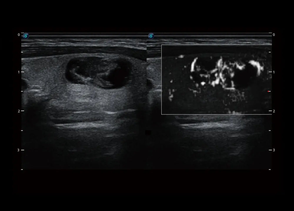 
                  
                    SonoScape P60 Trolley Color Doppler
                  
                
