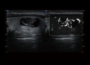 
                  
                    SonoScape P60 Trolley Color Doppler
                  
                