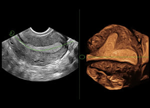 
                  
                    SonoScape P60 Exp Color Doppler
                  
                