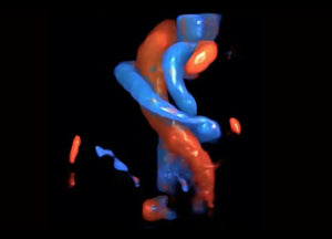 
                  
                    SonoScape P60 Exp Color Doppler
                  
                