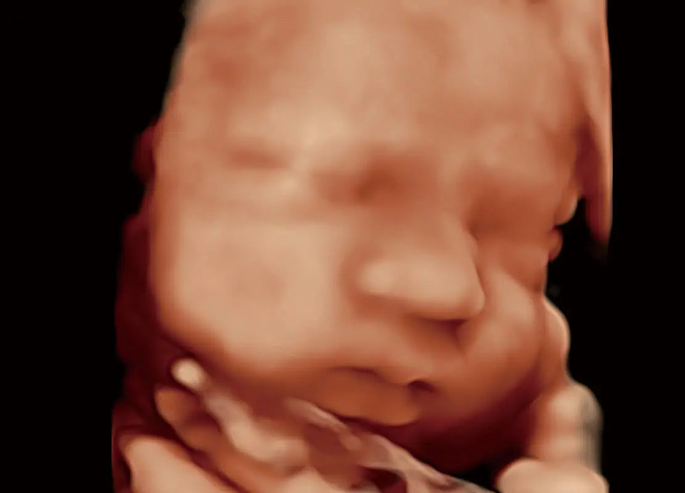 
                  
                    SonoScape P60 Exp Color Doppler
                  
                