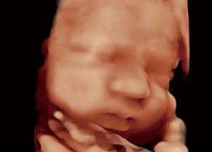 
                  
                    SonoScape P60 Exp Color Doppler
                  
                