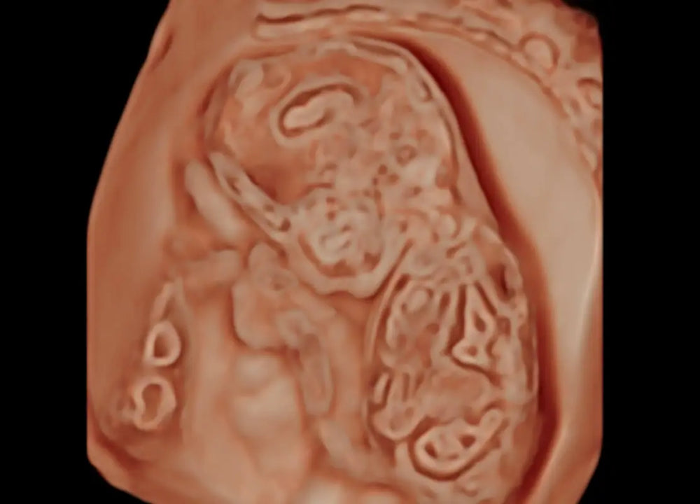 
                  
                    SonoScape P60 Exp Color Doppler
                  
                