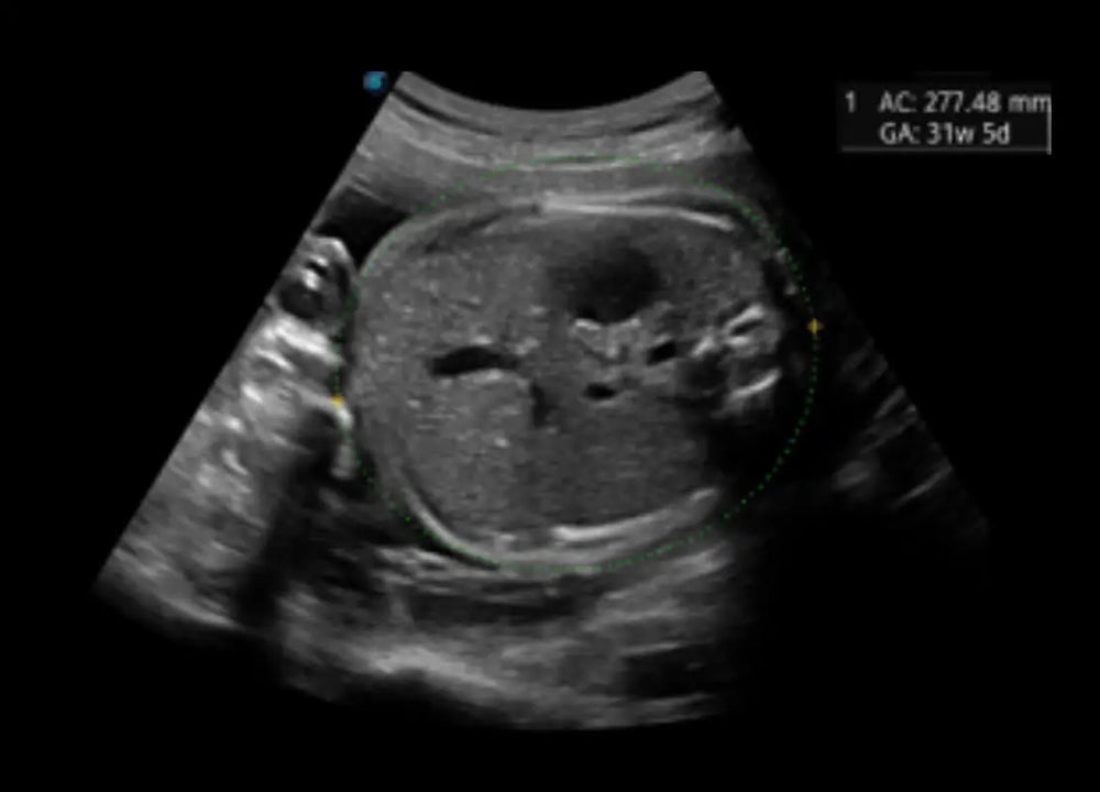 
                  
                    SonoScape P60 Exp Color Doppler
                  
                