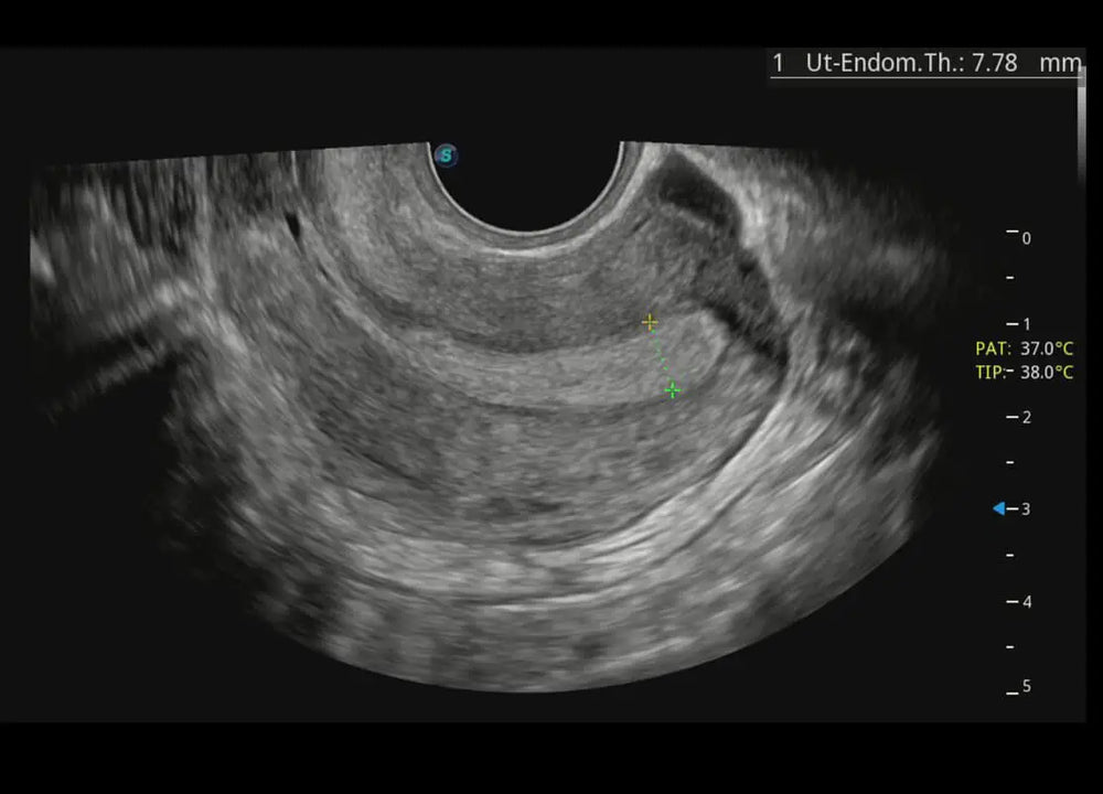 
                  
                    SonoScape P60 Exp Color Doppler
                  
                