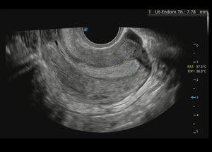 
                  
                    SonoScape P60 Exp Color Doppler
                  
                
