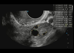 
                  
                    SonoScape P60 Exp Color Doppler
                  
                