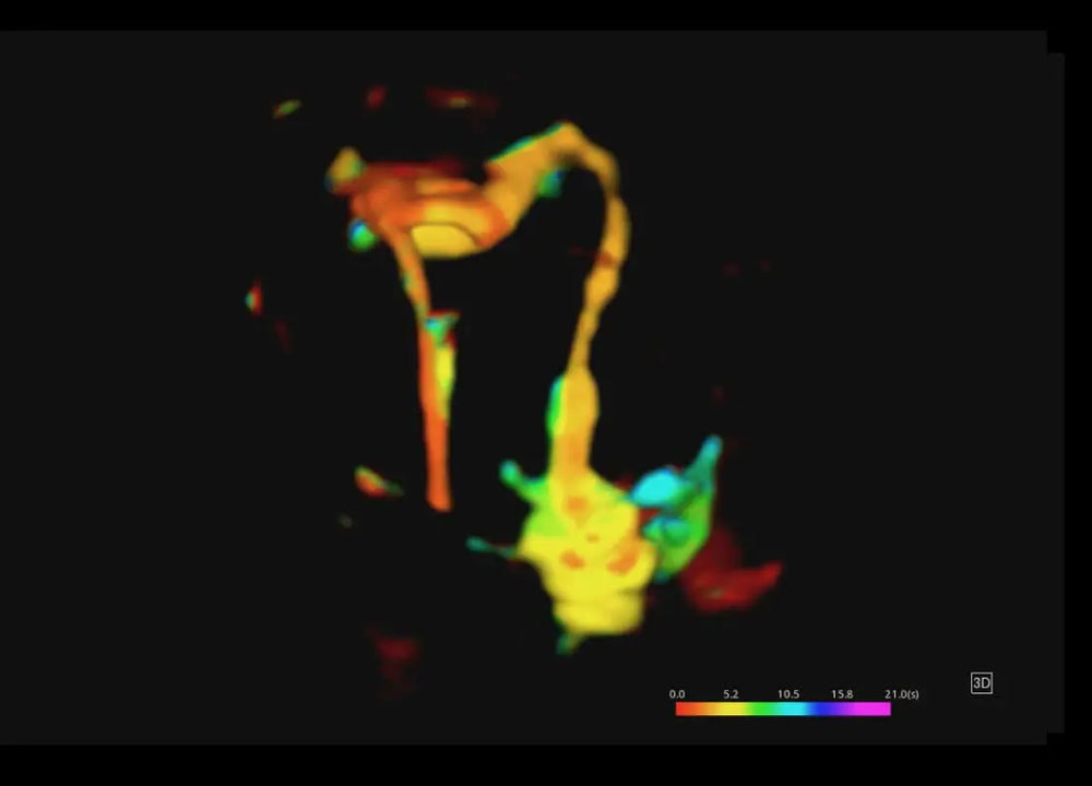 
                  
                    SonoScape P60 Exp Color Doppler
                  
                