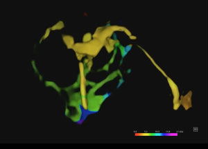 
                  
                    SonoScape P60 Exp Color Doppler
                  
                