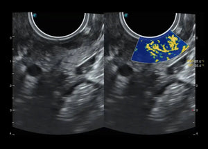 
                  
                    SonoScape P60 Exp Color Doppler
                  
                
