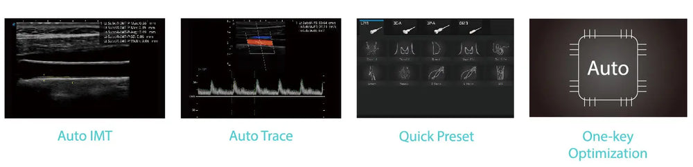 
                  
                    SonoScape P9 Trolley Ultrasound System
                  
                