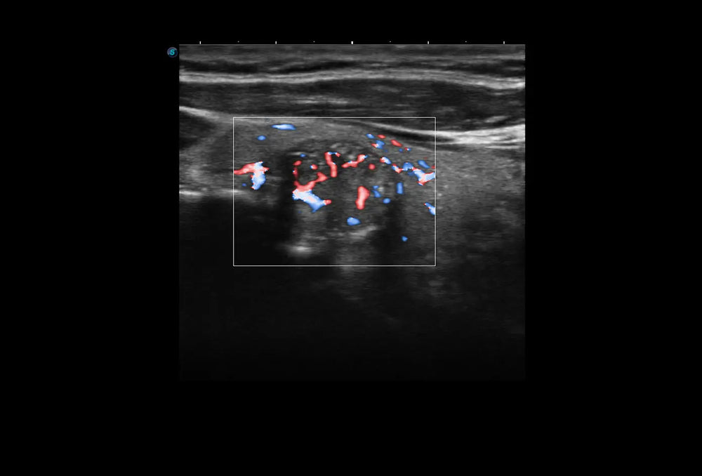 
                  
                    SonoScape P9 Trolley Ultrasound System
                  
                