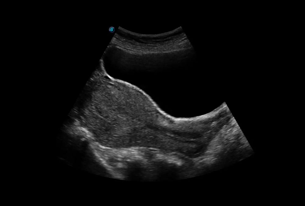 
                  
                    SonoScape P9 Trolley Ultrasound System
                  
                