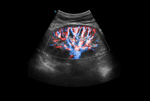 
                  
                    SonoScape P9 Trolley Ultrasound System
                  
                