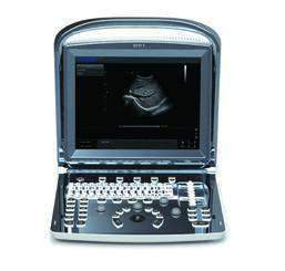 
                  
                    Chison ECO1 not listed
                  
                