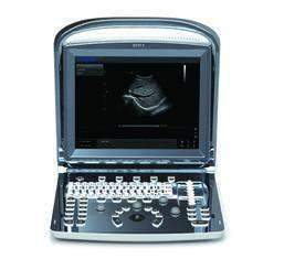 
                  
                    Chison ECO1 On Sale
                  
                