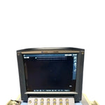 Sonosite MicroMaxx Portable Ultrasound Machine With HFL38 Probe | KeeboMed