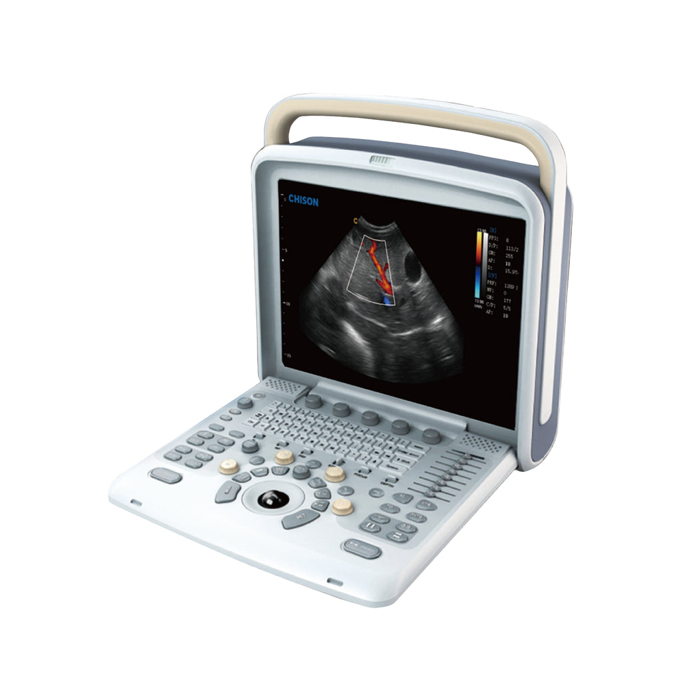 Chison Q5Vet Ultrasound for Veterinary | KeeboMed