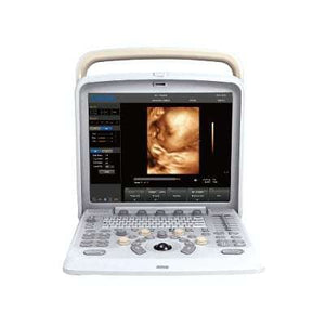 
                  
                    Chison Q5 with 4D Ultrasound, Clear Imaging, Advanced Software | KeeboMed
                  
                