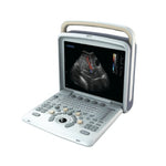 Chison Q5 Demo Human Ultrasound | KeeboMed