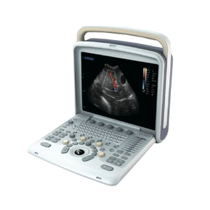 
                  
                    Chison Q5 Demo Human Ultrasound | KeeboMed
                  
                