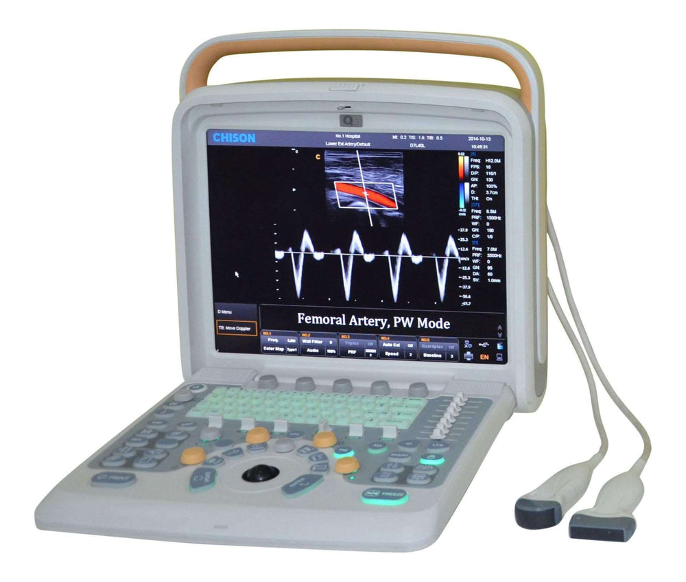 CHISON Q5 | Color Doppler Portable Ultrasound Machine 