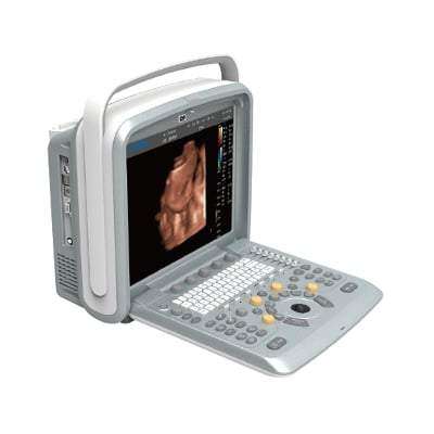 Chison Q9 With 4D Color Doppler, Excellent Image Quality | KeeboMed