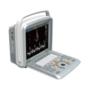 
                  
                    Chison Q9 Color Doppler Ultrasound Machine
                  
                