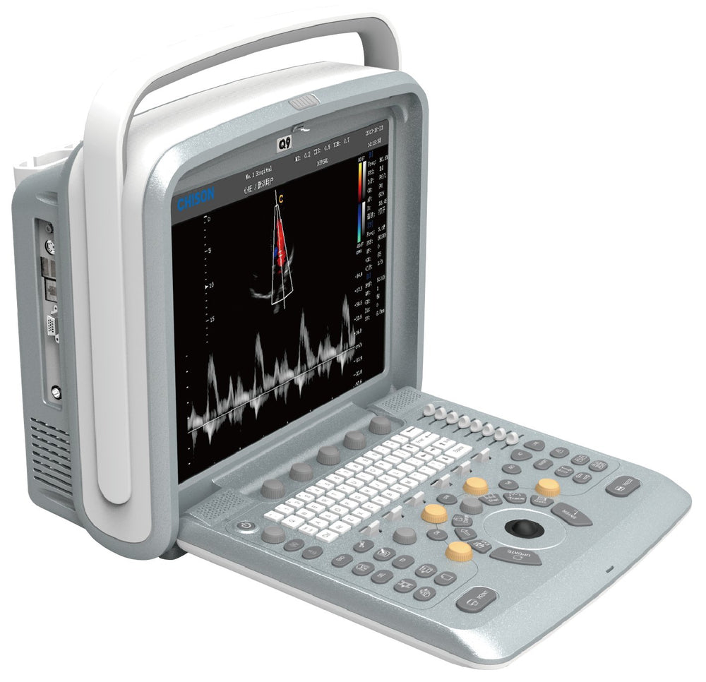 
                  
                    Chison Q9Vet Color Doppler Veterinary Ultrasound | KeeboMed
                  
                