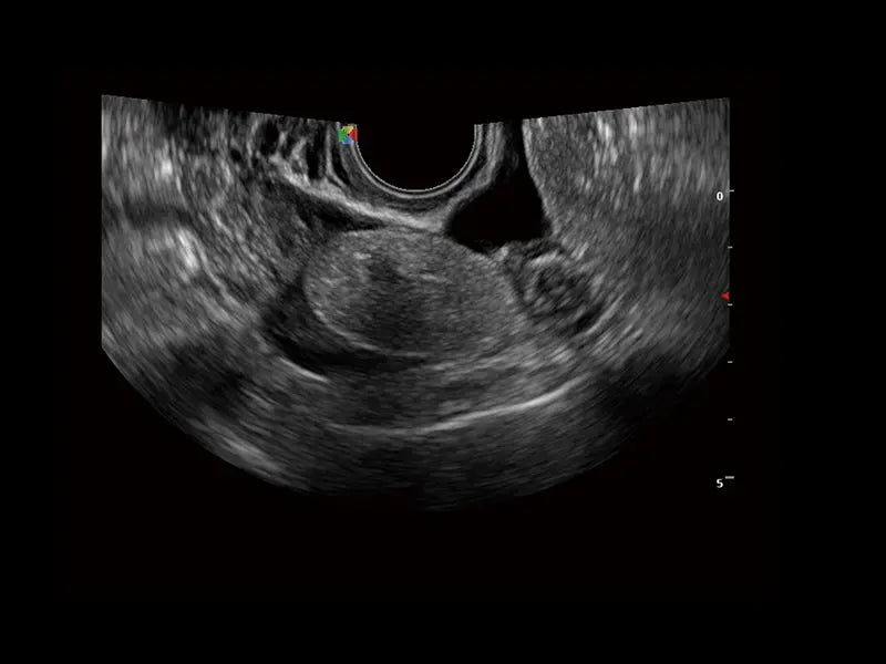 
                  
                    SonoScape S30 Trolley Ultrasound System
                  
                