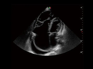 
                  
                    SonoScape S30 Trolley Ultrasound System
                  
                