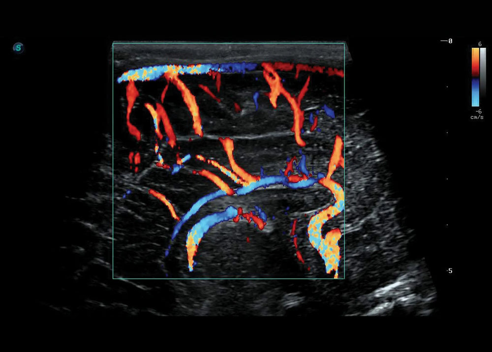 
                  
                    SonoScape S50 Trolley Color Doppler Ultrasound
                  
                