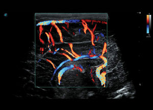 
                  
                    SonoScape S50 Trolley Color Doppler Ultrasound
                  
                