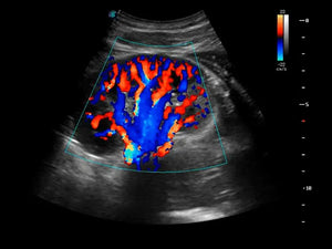 
                  
                    SonoScape S50 Trolley Color Doppler Ultrasound
                  
                