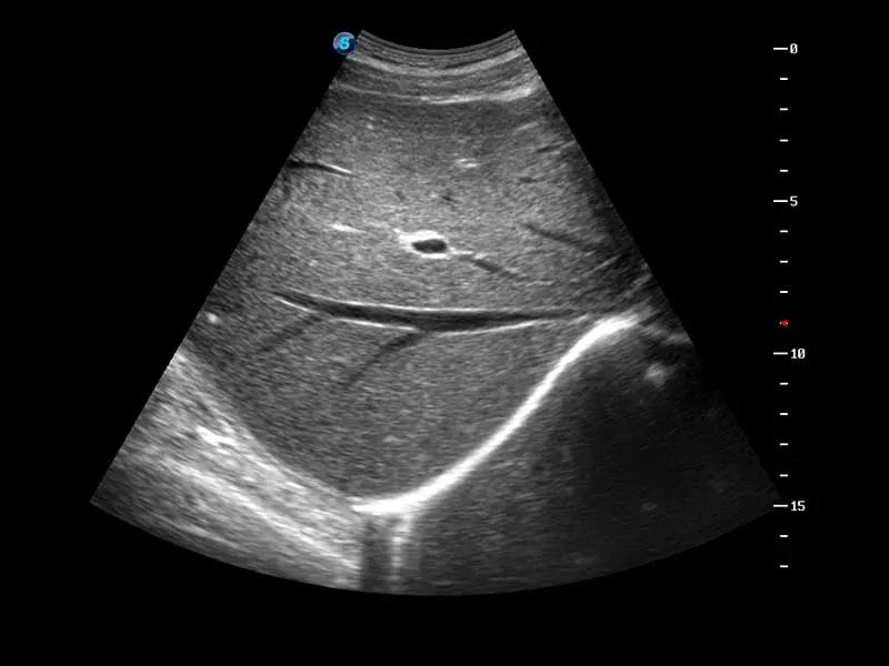 
                  
                    SonoScape S50 Trolley Color Doppler Ultrasound
                  
                