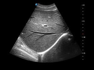 
                  
                    SonoScape S50 Trolley Color Doppler Ultrasound
                  
                