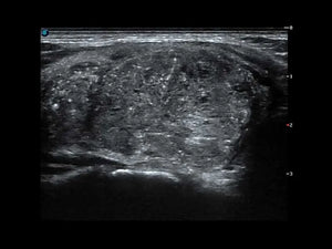 
                  
                    SonoScape S50 Trolley Color Doppler Ultrasound
                  
                