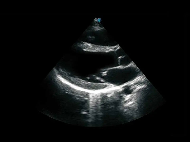 
                  
                    SonoScape S50 Trolley Color Doppler Ultrasound
                  
                