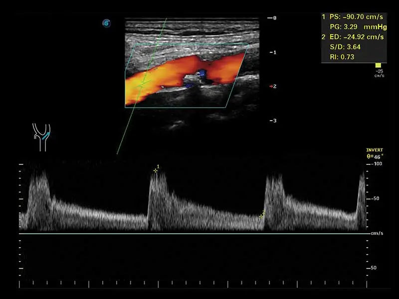 
                  
                    SonoScape S50 Trolley Color Doppler Ultrasound
                  
                