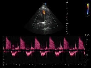 
                  
                    SonoScape S50 Trolley Color Doppler Ultrasound
                  
                