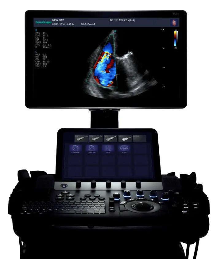 
                  
                    SonoScape S50 Trolley Color Doppler Ultrasound
                  
                