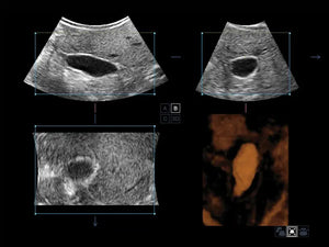 
                  
                    SonoScape S50 Trolley Color Doppler Ultrasound
                  
                