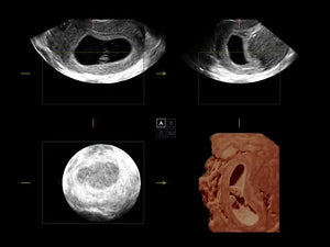 
                  
                    SonoScape S50 Trolley Color Doppler Ultrasound
                  
                