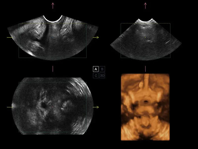 
                  
                    SonoScape S50 Trolley Color Doppler Ultrasound
                  
                