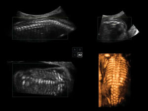 
                  
                    SonoScape S50 Trolley Color Doppler Ultrasound
                  
                