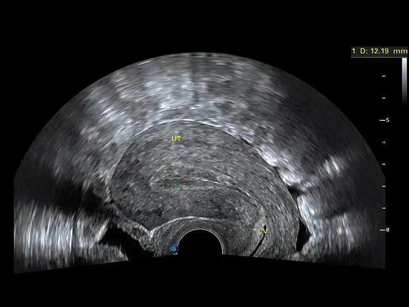 
                  
                    SonoScape S50 Trolley Color Doppler Ultrasound
                  
                