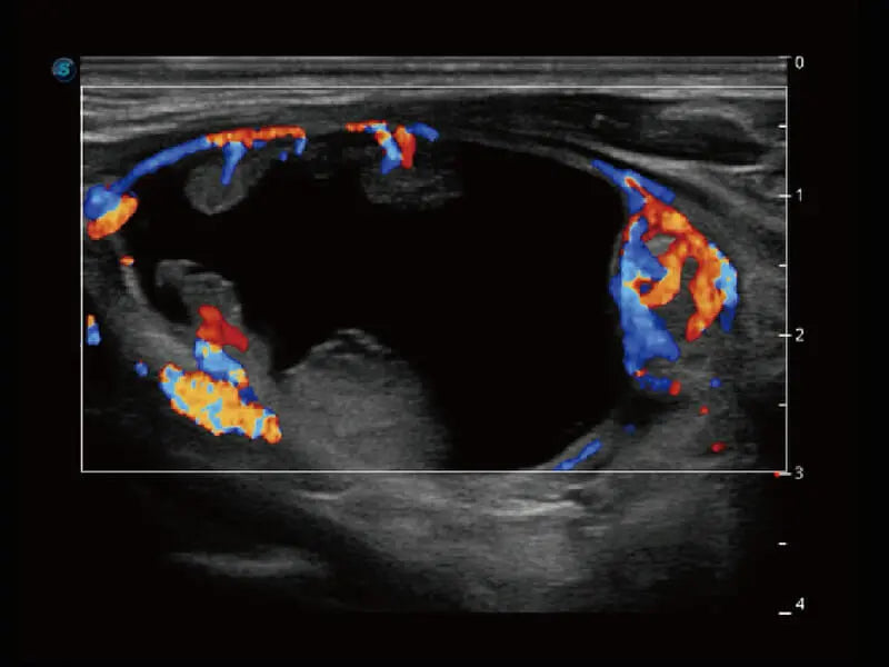 
                  
                    SonoScape S60 Trolley Color Doppler
                  
                